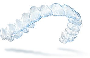 Patients From Charlotte Seek Straight Teeth With Invisalign Braces